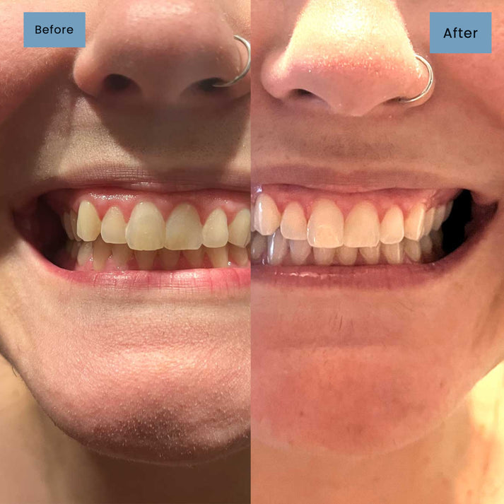 InstantWhite Toothpaste