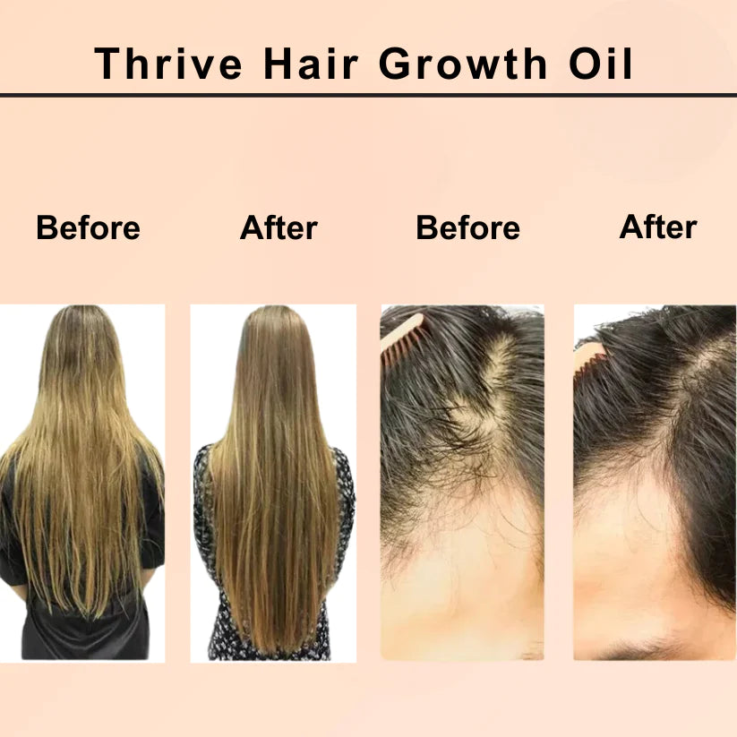 Natural Hair Growth Oil