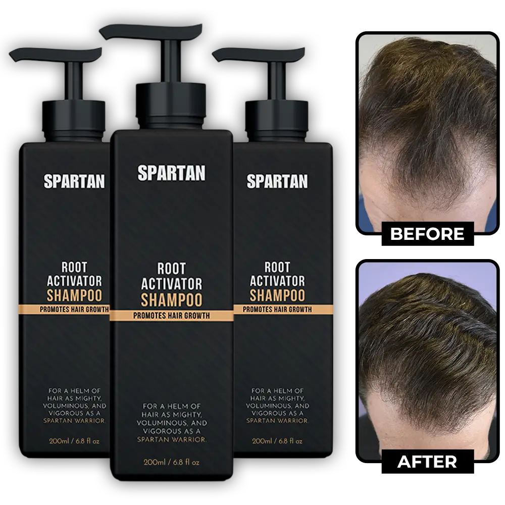 Root Activator Shampoo For Men Hair Loss