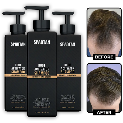 Root Activator Shampoo For Men Hair Loss