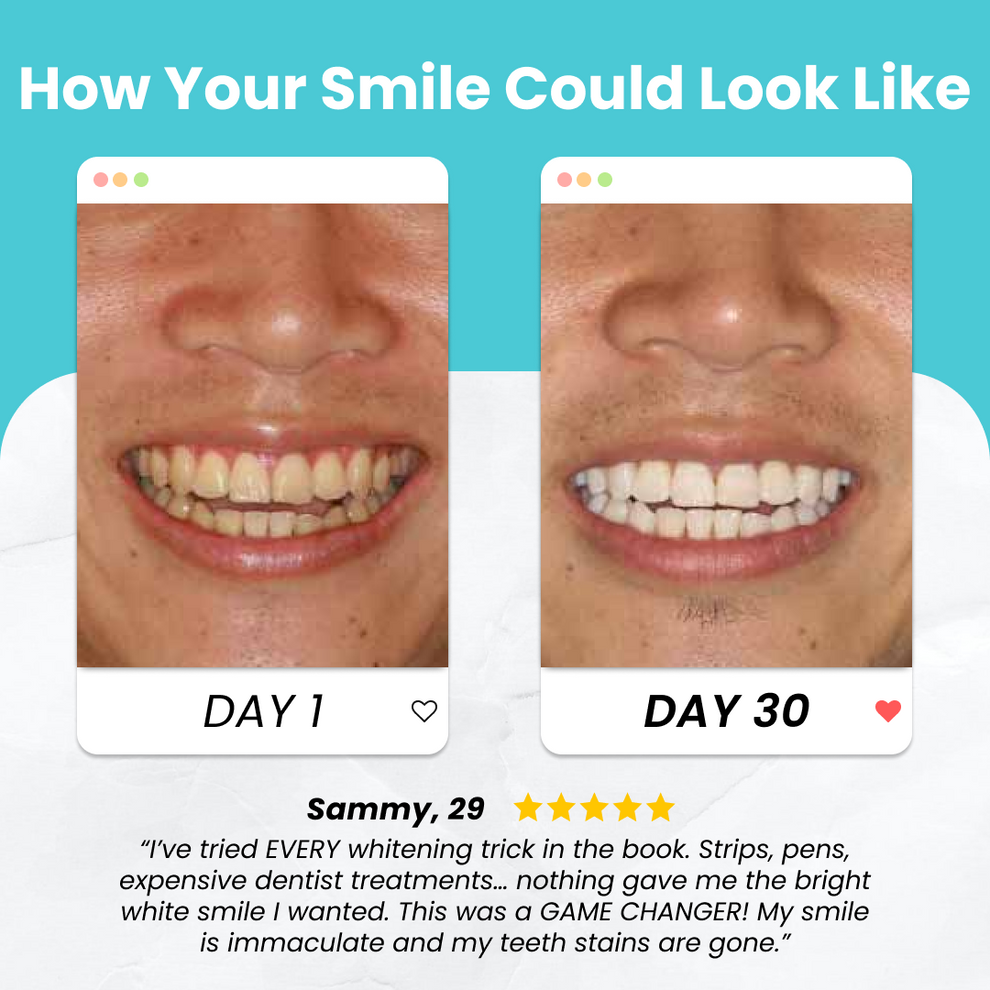 WhiteSmile | The Ultimate Innovation in Dental Care 🦷