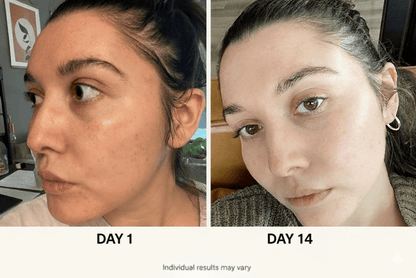 Korean Glass Skin Routine Set