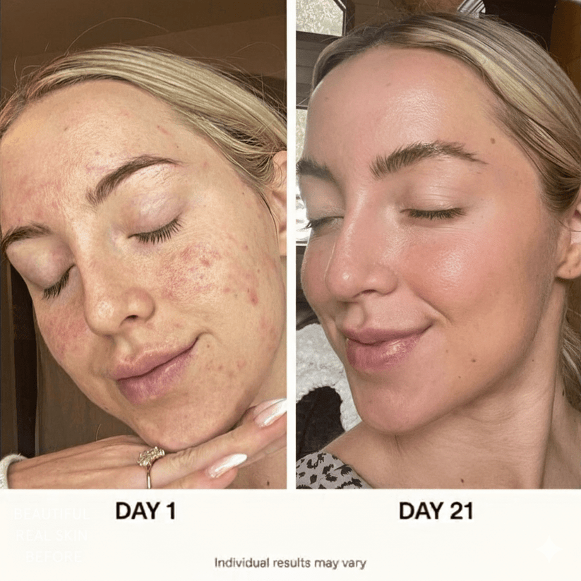 Korean Glass Skin Routine Set