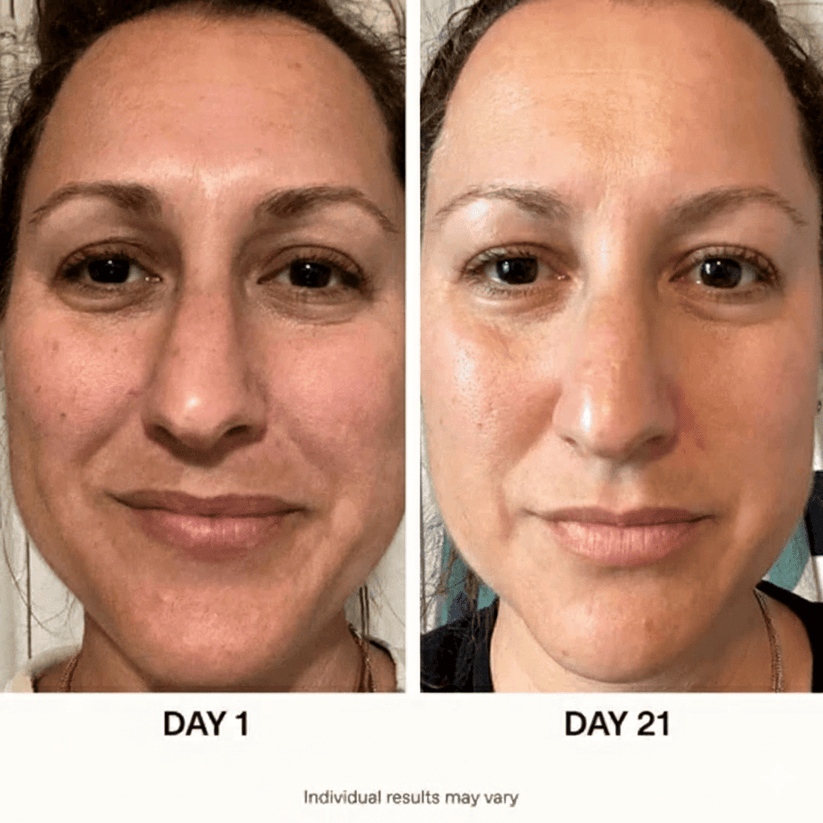 Korean Glass Skin Routine Set