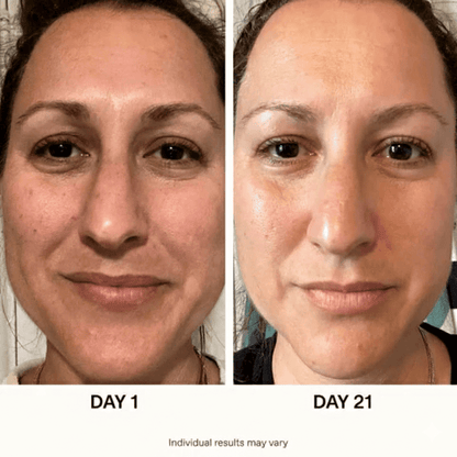 Korean Glass Skin Routine Set