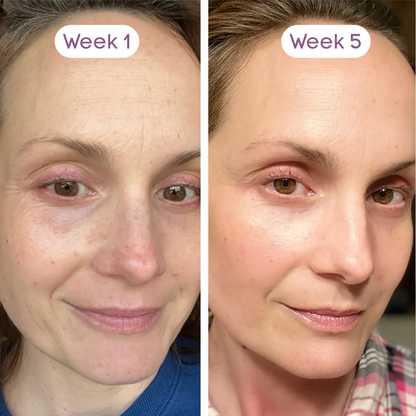 NMN 10-In-1 Anti-Aging Complex