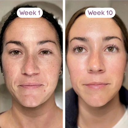 NMN 10-In-1 Anti-Aging Complex